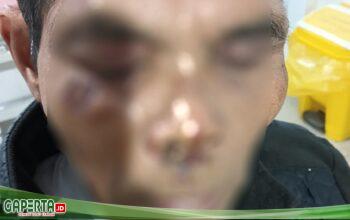 Kepala Desa Aniaya Karimun Silitonga Hingga Babak Belur