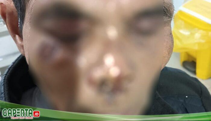 Kepala Desa Aniaya Karimun Silitonga Hingga Babak Belur