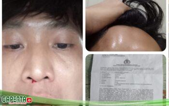 Wartawan Jadi Korban Pengeroyokan di Batanghari, Kasus Resmi Dilaporkan ke Polda Jambi